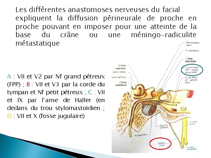 Les différentes anastomoses nerveuses du facial expliquent la diffusion périneurale de proche en proche