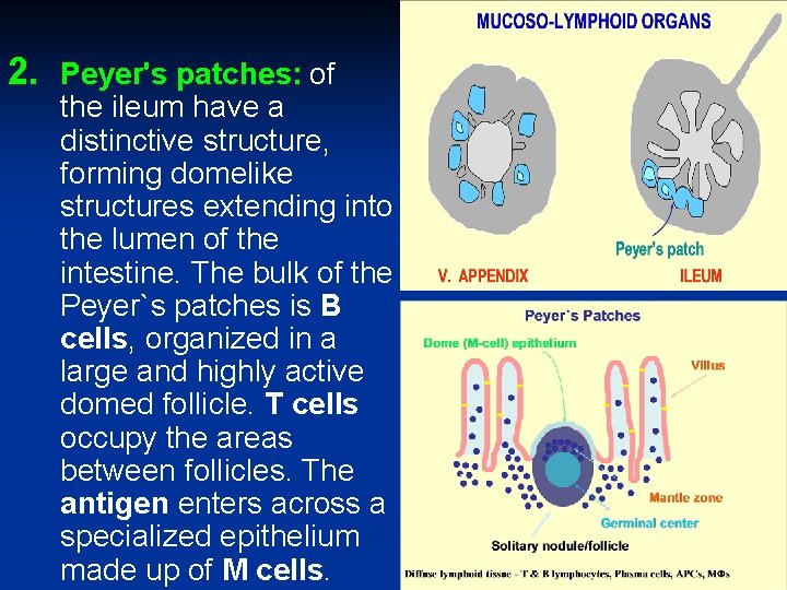 2. Peyer's patches: of the ileum have a distinctive structure, forming domelike structures extending