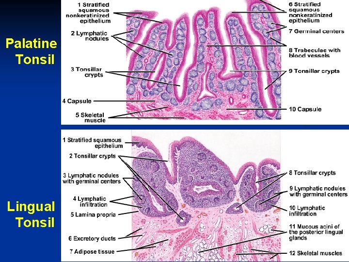 Palatine Tonsil Lingual Tonsil 