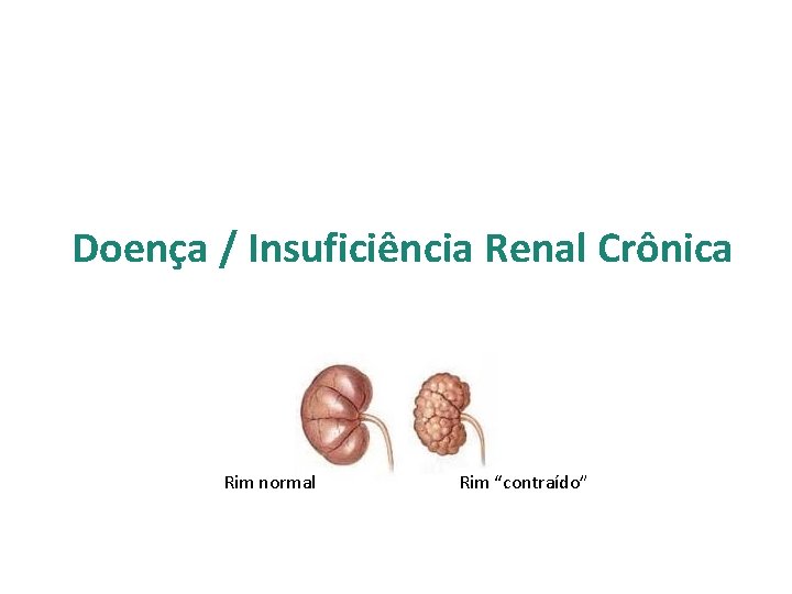 Doença / Insuficiência Renal Crônica Rim normal Rim “contraído” 