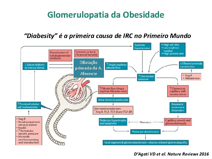Glomerulopatia da Obesidade “Diabesity” é a primeira causa de IRC no Primeiro Mundo Dilatação
