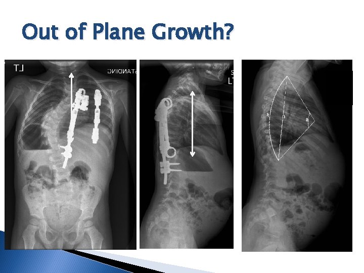 Out of Plane Growth? 