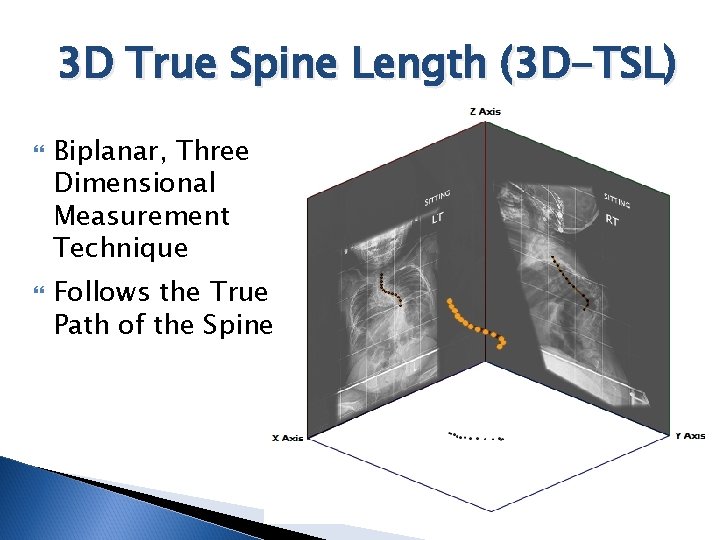 3 D True Spine Length (3 D-TSL) Biplanar, Three Dimensional Measurement Technique Follows the