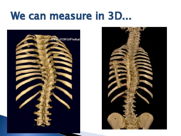 We can measure in 3 D. . . 