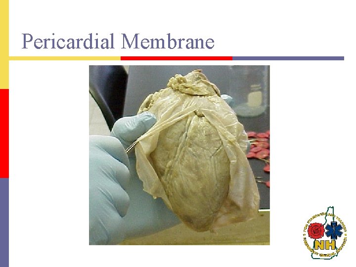 Pericardial Membrane 