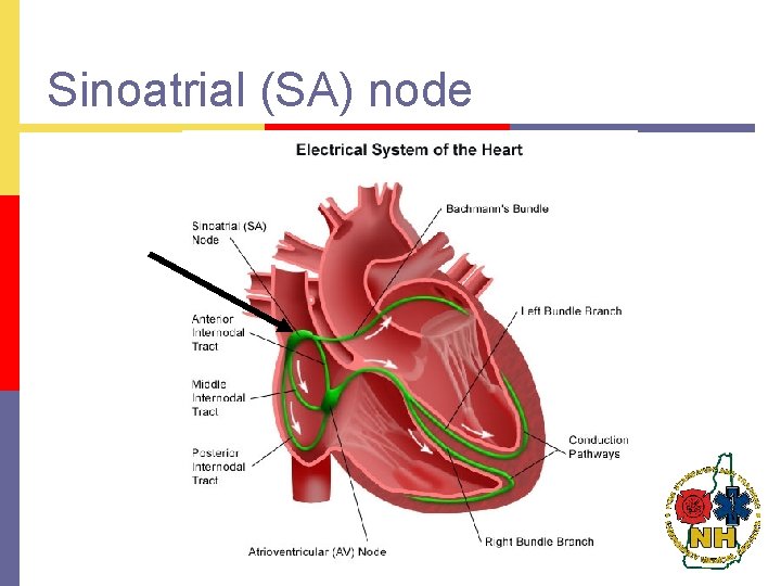 Sinoatrial (SA) node 
