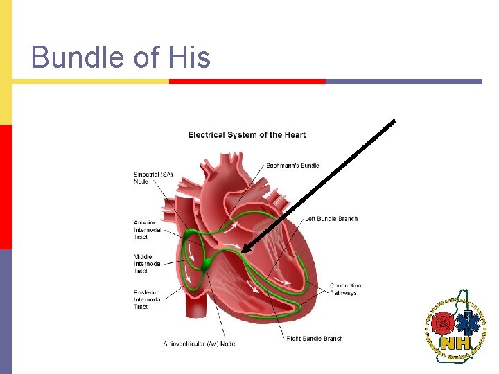 Bundle of His 