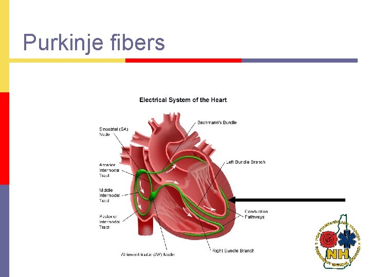 Purkinje fibers 