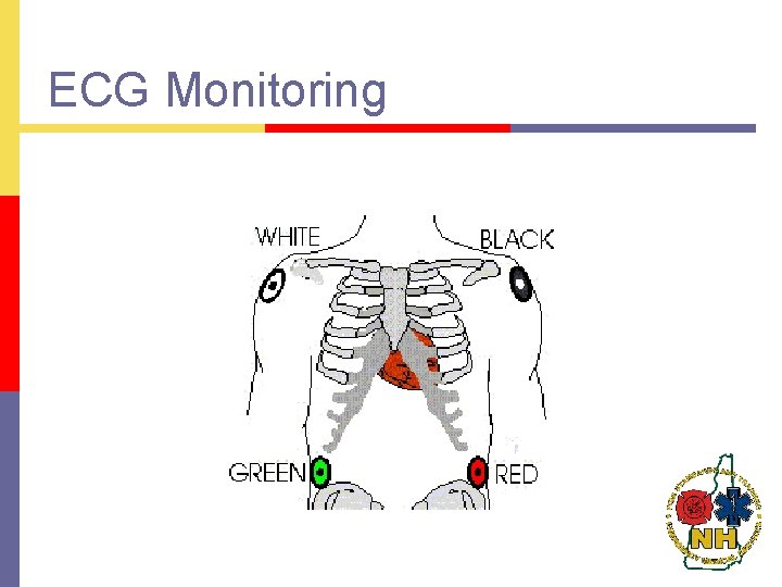 ECG Monitoring 