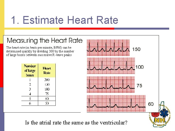 1. Estimate Heart Rate Is the atrial rate the same as the ventricular? 