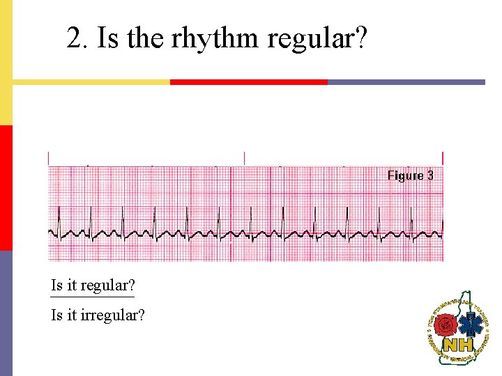 2. Is the rhythm regular? Is it regular? Is it irregular? 
