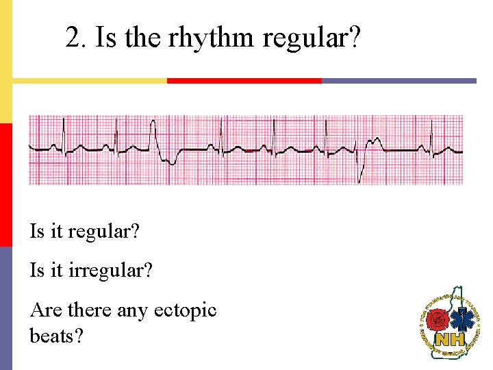 2. Is the rhythm regular? Is it regular? Is it irregular? Are there any