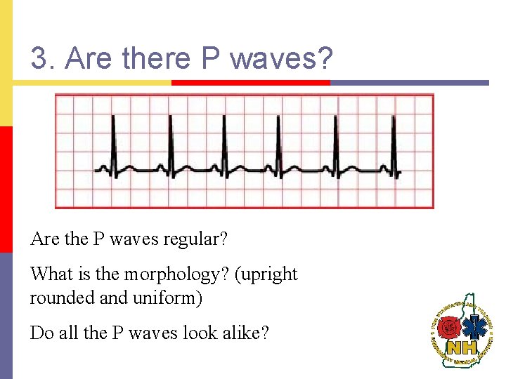 3. Are there P waves? Are the P waves regular? What is the morphology?