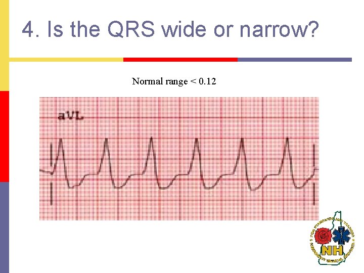 4. Is the QRS wide or narrow? Normal range < 0. 12 