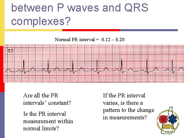 between P waves and QRS complexes? Normal PR interval = 0. 12 – 0.