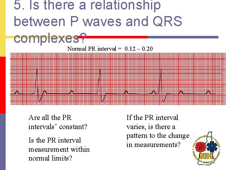 5. Is there a relationship between P waves and QRS complexes? Normal PR interval