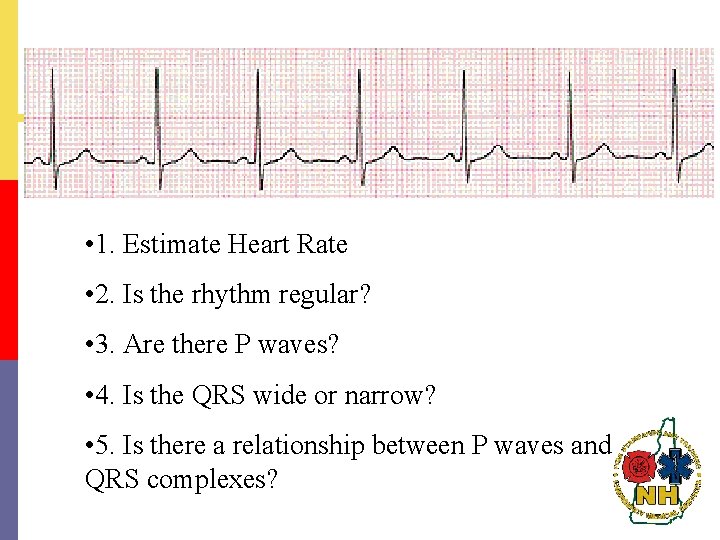  • 1. Estimate Heart Rate • 2. Is the rhythm regular? • 3.