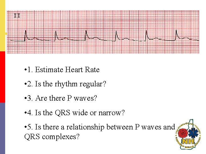  • 1. Estimate Heart Rate • 2. Is the rhythm regular? • 3.