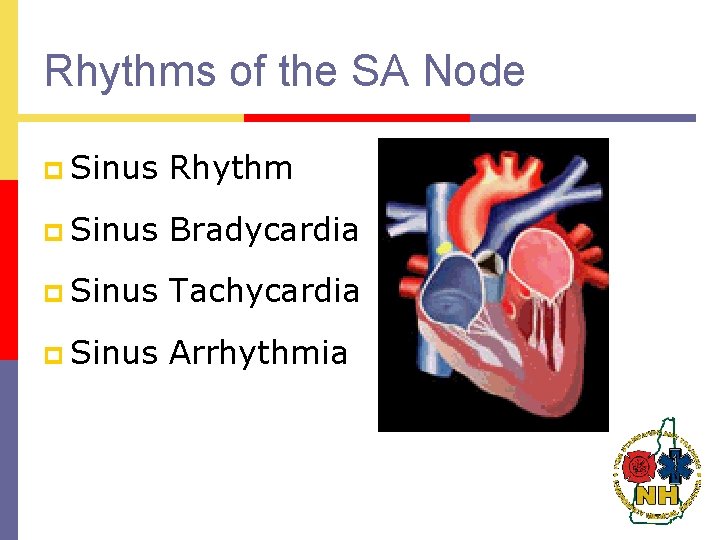 Rhythms of the SA Node p Sinus Rhythm p Sinus Bradycardia p Sinus Tachycardia