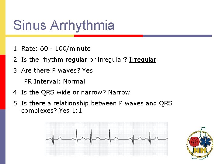 Sinus Arrhythmia 1. Rate: 60 - 100/minute 2. Is the rhythm regular or irregular?