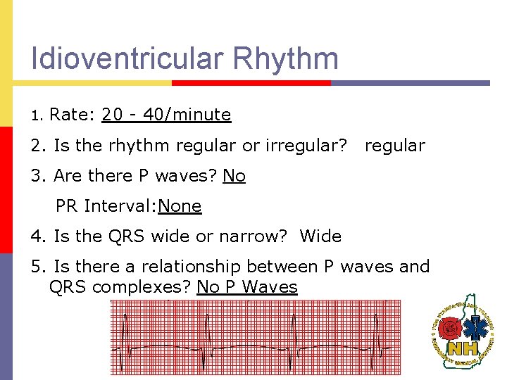 Idioventricular Rhythm 1. Rate: 20 - 40/minute 2. Is the rhythm regular or irregular?