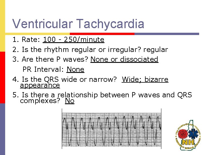 Ventricular Tachycardia 1. Rate: 100 - 250/minute 2. Is the rhythm regular or irregular?