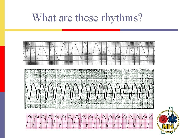 What are these rhythms? 