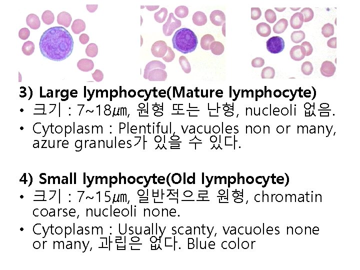 3) Large lymphocyte(Mature lymphocyte) • 크기 : 7~18㎛, 원형 또는 난형, nucleoli 없음. •