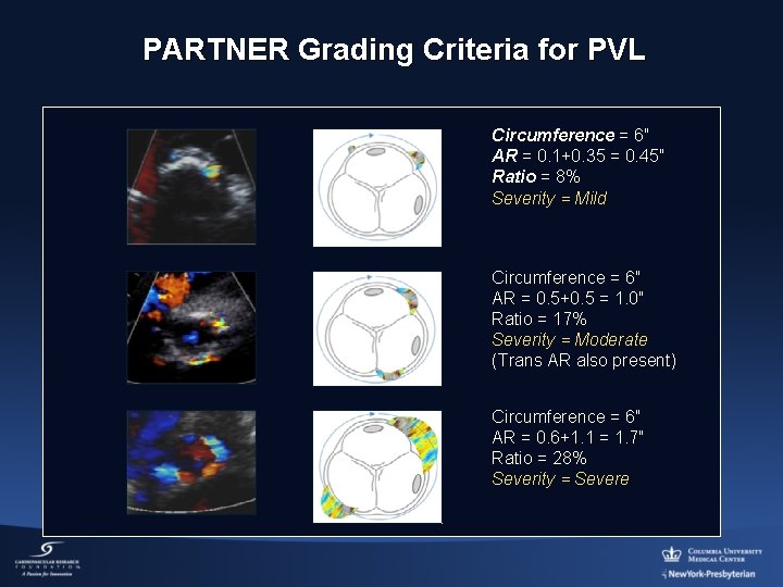 PARTNER Grading Criteria for PVL Circumference = 6″ AR = 0. 1+0. 35 =