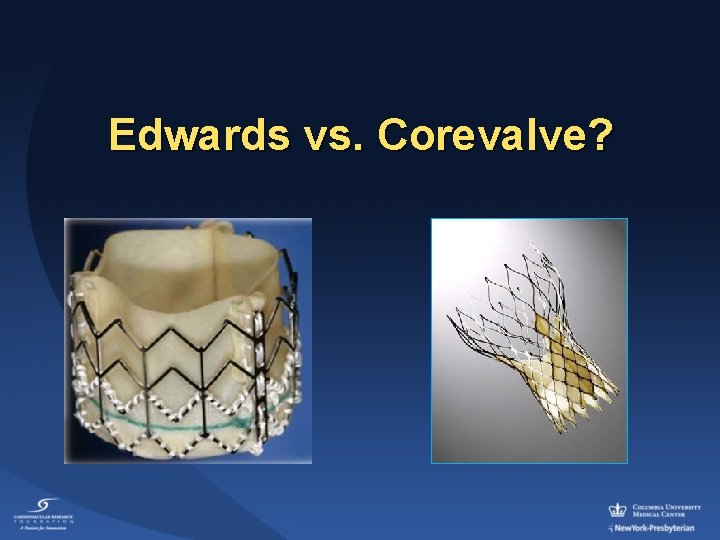 Edwards vs. Corevalve? 