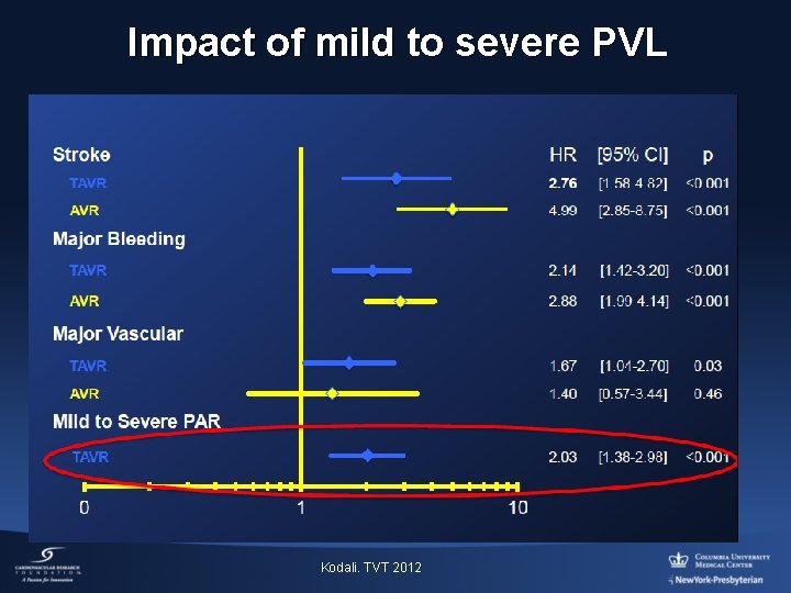 Impact of mild to severe PVL Kodali. TVT 2012 