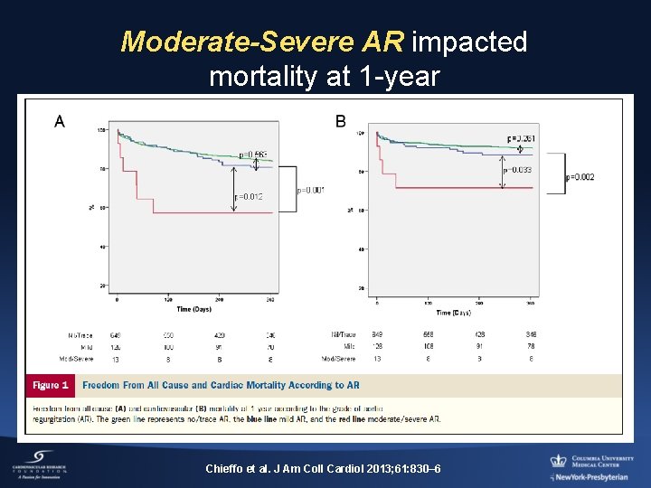 Moderate-Severe AR impacted mortality at 1 -year Chieffo et al. J Am Coll Cardiol