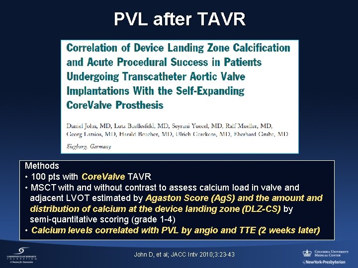 PVL after TAVR Methods • 100 pts with Core. Valve TAVR • MSCT with