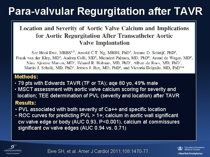 Para-valvular Regurgitation after TAVR Methods: • 79 pts with Edwards TAVR (TF or TA);