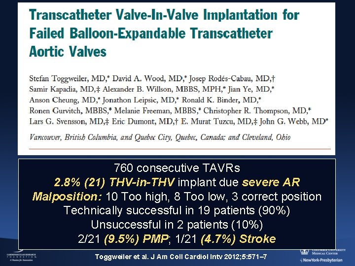 760 consecutive TAVRs 2. 8% (21) THV-in-THV implant due severe AR Malposition: 10 Too