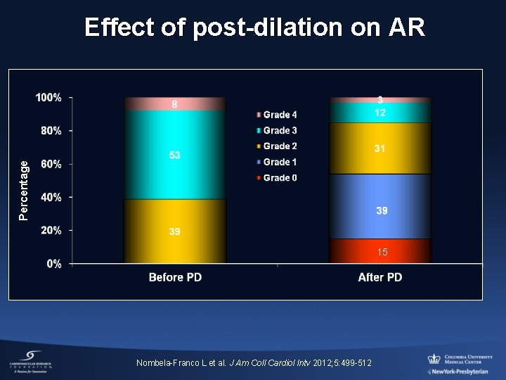Percentage Effect of post-dilation on AR 15 Nombela-Franco L et al. J Am Coll