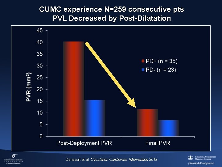 CUMC experience N=259 consecutive pts PVL Decreased by Post-Dilatation Daneault et al. Circulation Cardiovasc