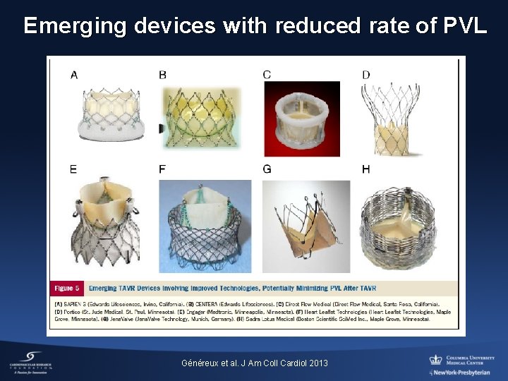 Emerging devices with reduced rate of PVL Généreux et al. J Am Coll Cardiol