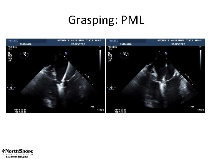 Grasping: PML 