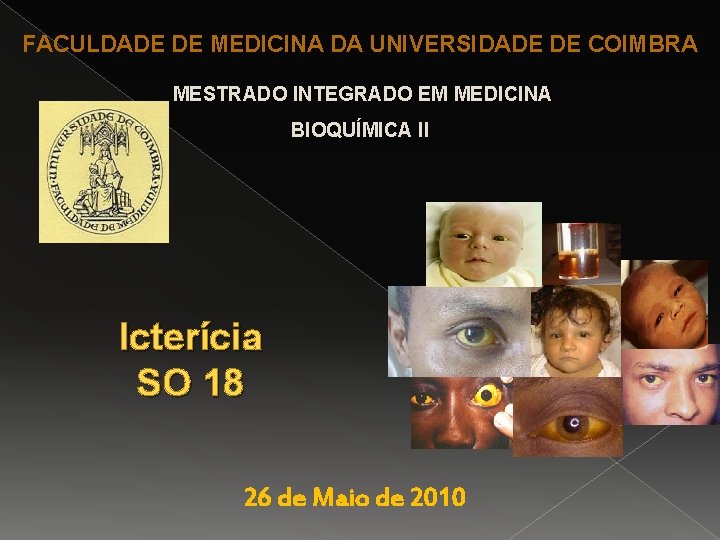 FACULDADE DE MEDICINA DA UNIVERSIDADE DE COIMBRA MESTRADO INTEGRADO EM MEDICINA BIOQUÍMICA II Icterícia