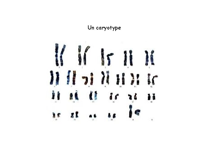 Un caryotype 