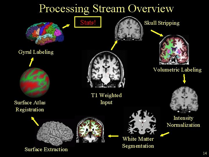 Processing Stream Overview Stats! Skull Stripping Gyral Labeling Volumetric Labeling Surface Atlas Registration T