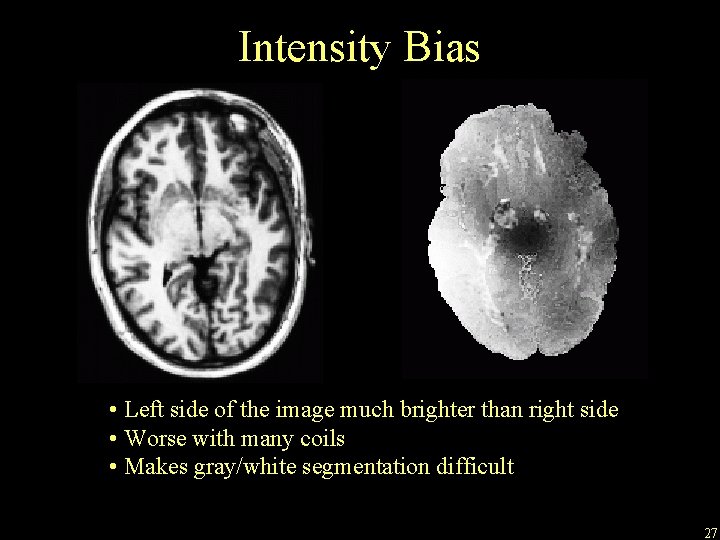 Intensity Bias • Left side of the image much brighter than right side •