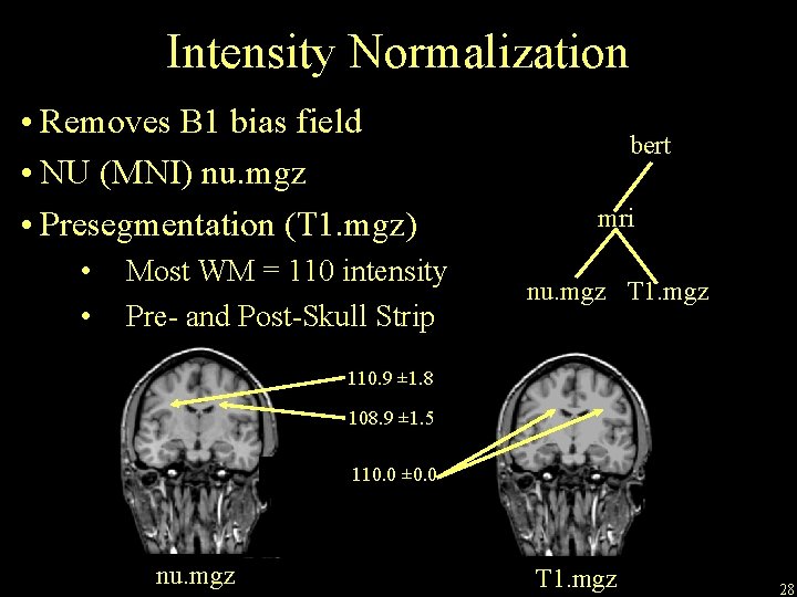 Intensity Normalization • Removes B 1 bias field • NU (MNI) nu. mgz •