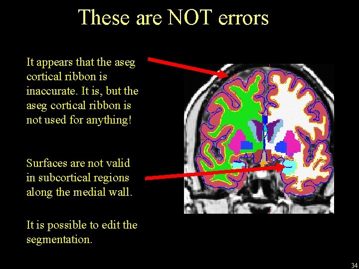 These are NOT errors It appears that the aseg cortical ribbon is inaccurate. It