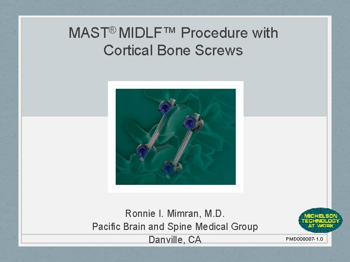 MAST® MIDLF™ Procedure with Cortical Bone Screws Ronnie I. Mimran, M. D. Pacific Brain