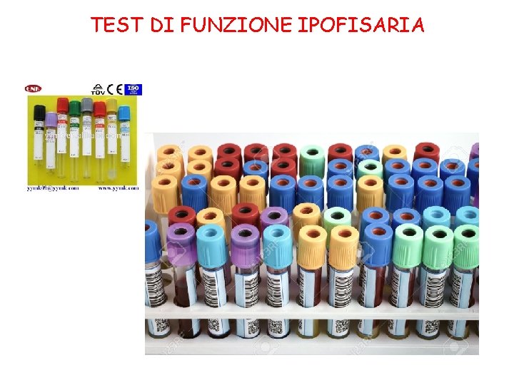 TEST DI FUNZIONE IPOFISARIA 