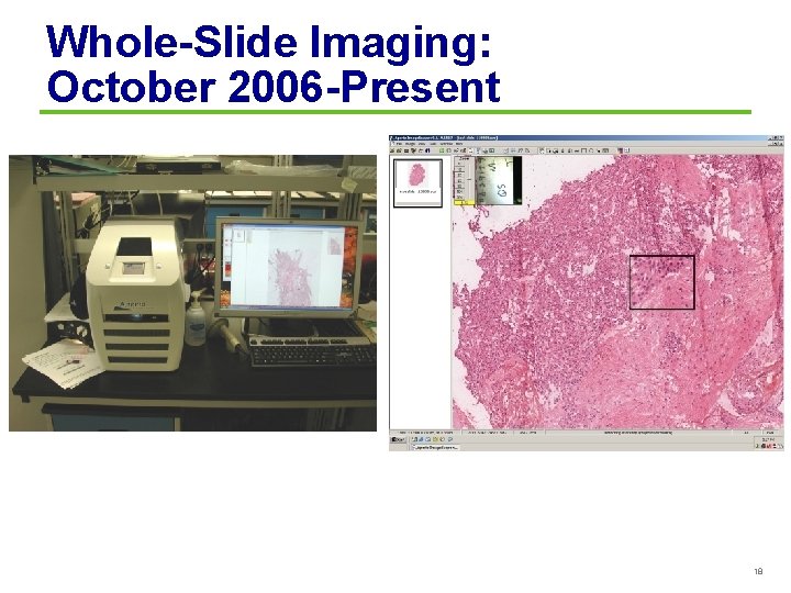 Whole-Slide Imaging: October 2006 -Present 18 