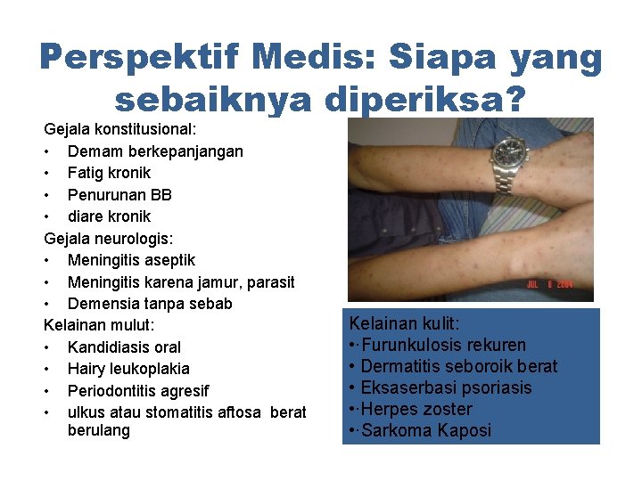 Perspektif Medis: Siapa yang sebaiknya diperiksa? Gejala konstitusional: • Demam berkepanjangan • Fatig kronik