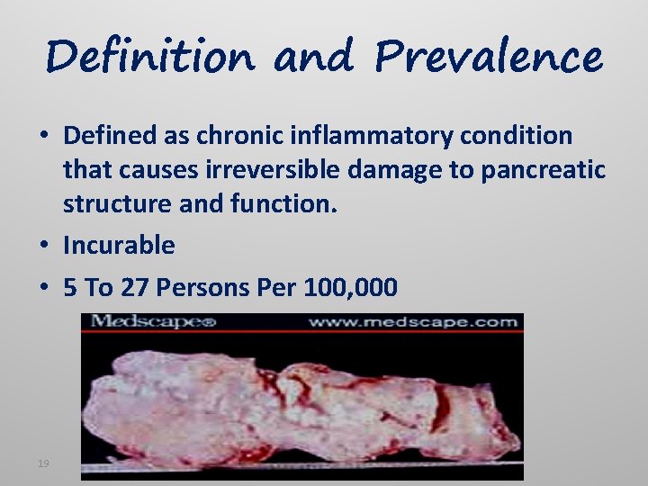 Definition and Prevalence • Defined as chronic inflammatory condition that causes irreversible damage to